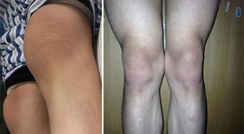 ֣��ʹ���ʪ��ҽԺ-��ʪ����